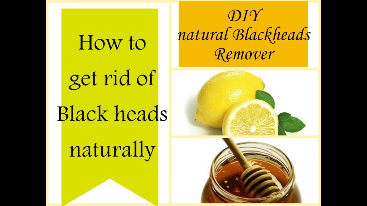 How to get rid of blackheads naturally at home